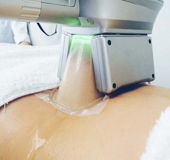 CRIOLIPÓLISE EM TERESINA/PI